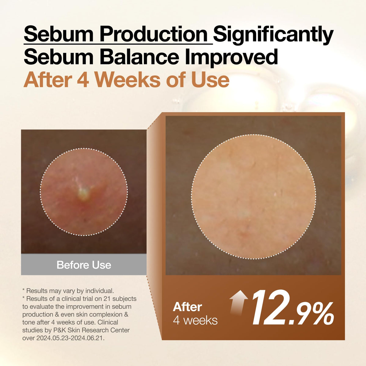 Anua Heartleaf 77 Soothing Toner, 8.45 fl.oz
