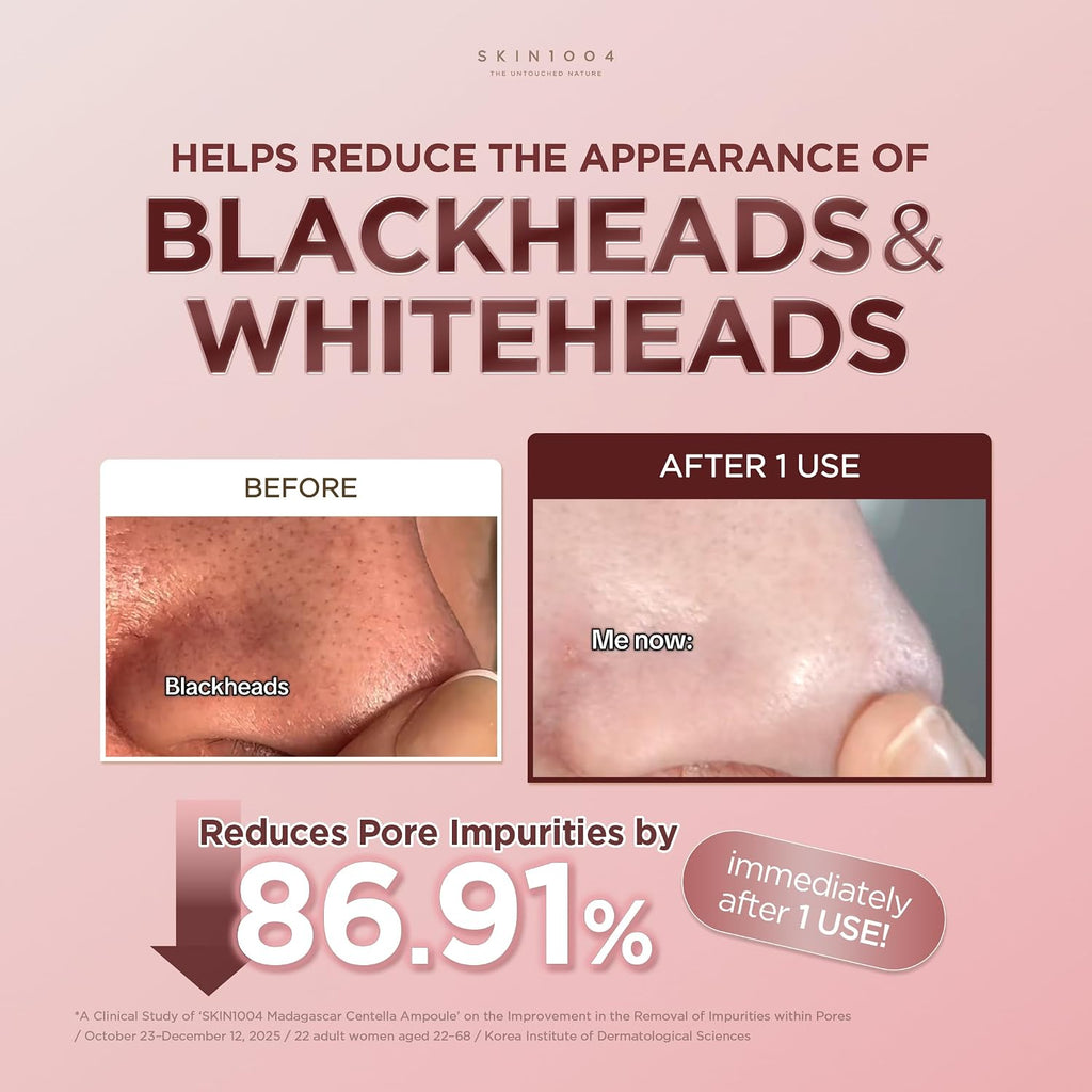 SKIN1004 [Hudson's Pick] Poremizing Quick Clay Stick Mask, Facial Clay Mask for Pores, Centella Clay Stick for Pore Minimizing, Pink Pore Mud Mask for Sebum Balance, Korean Skin Care, 0.95 oz / 27g