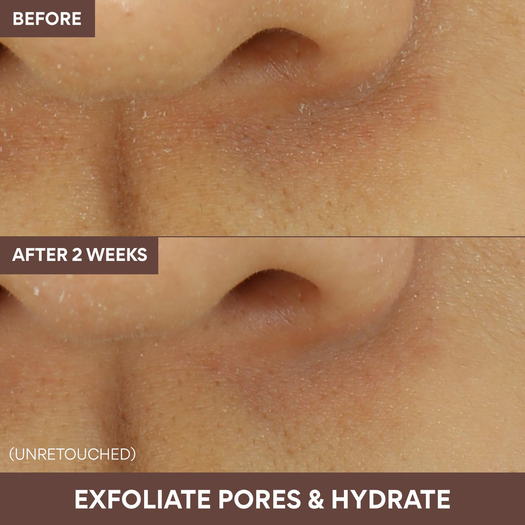 innisfree - Super Volcanic Pore Clay Mask