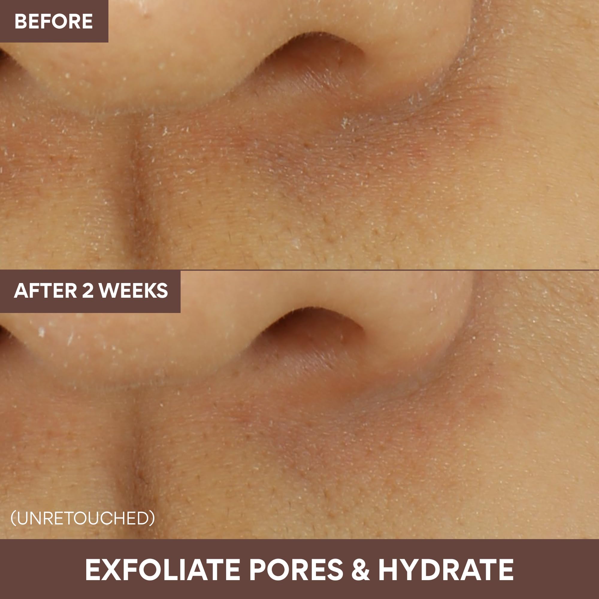 innisfree - Super Volcanic Pore Clay Mask